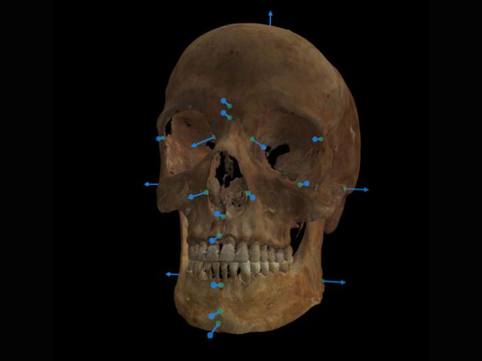 Curso Extendido de Superposición Craneofacial