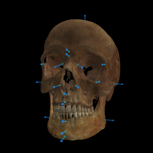 Curso Extendido de Superposición Craneofacial