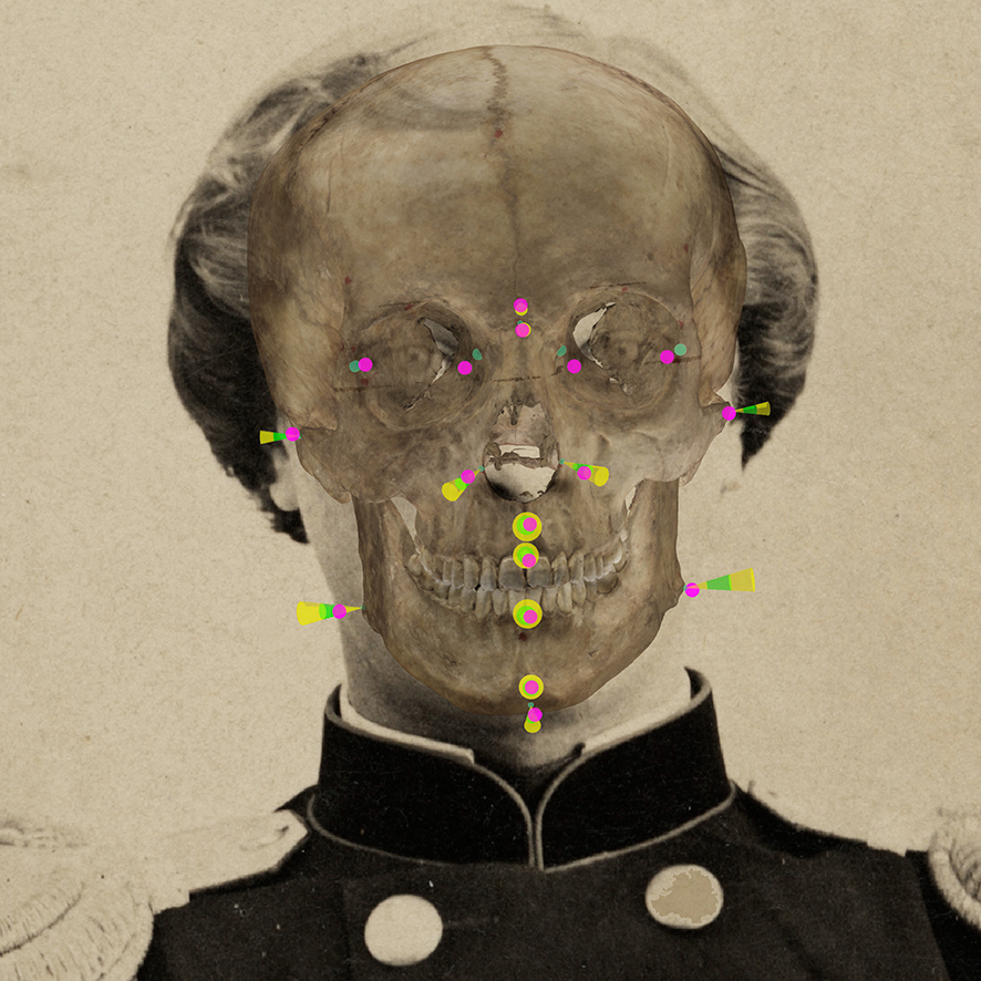 Curso de Fundamentos de la Superposición Craneofacial